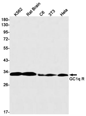 Anti-GC1q R Rabbit Monoclonal Antibody