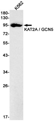 Anti-KAT2A Rabbit Monoclonal Antibody