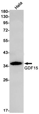Anti-GDF15 Rabbit Monoclonal Antibody