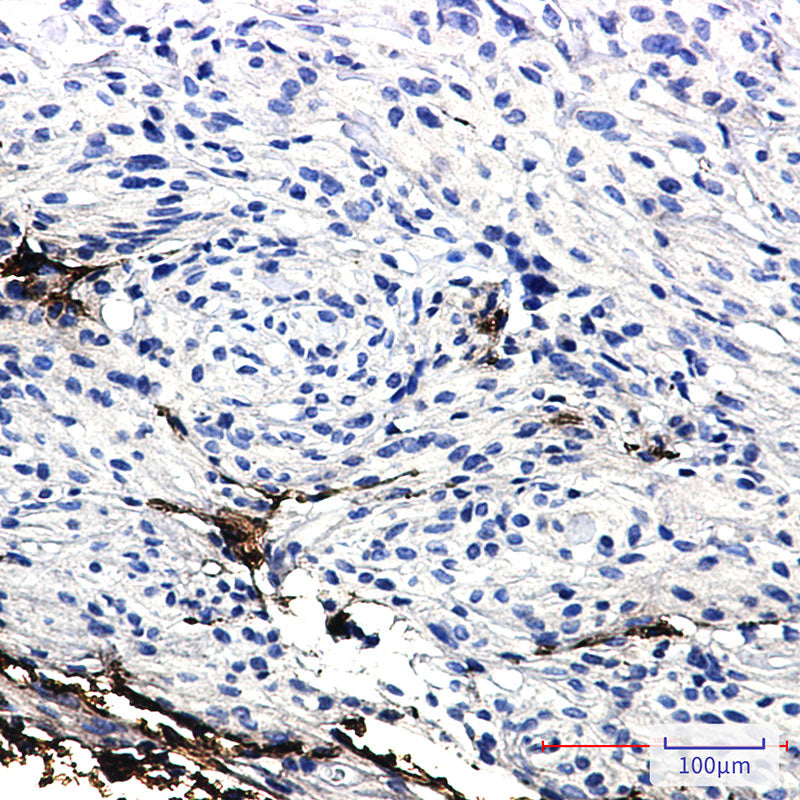 Anti-GFAP Rabbit Monoclonal Antibody