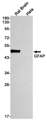 Anti-GFAP Rabbit Monoclonal Antibody