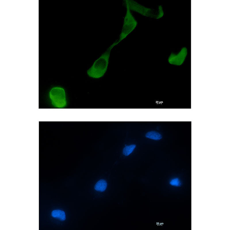 Anti-GFPT2 Rabbit Monoclonal Antibody