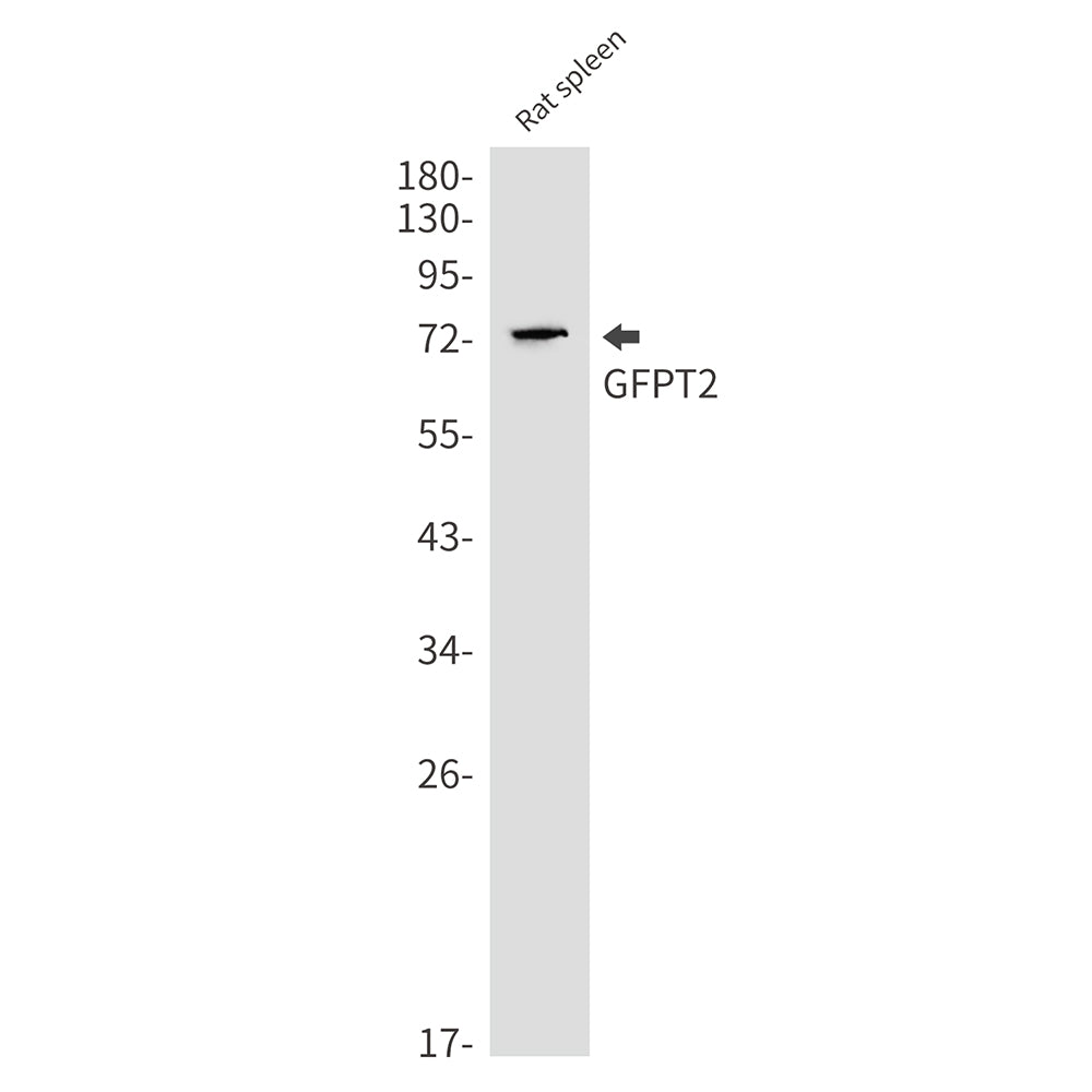 Anti-GFPT2 Rabbit Monoclonal Antibody
