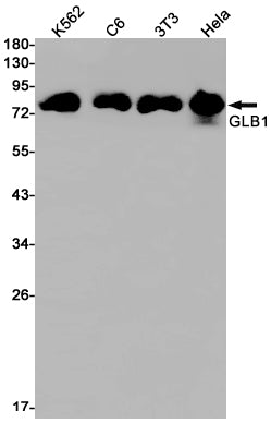 Anti-GLB1 Rabbit Monoclonal Antibody