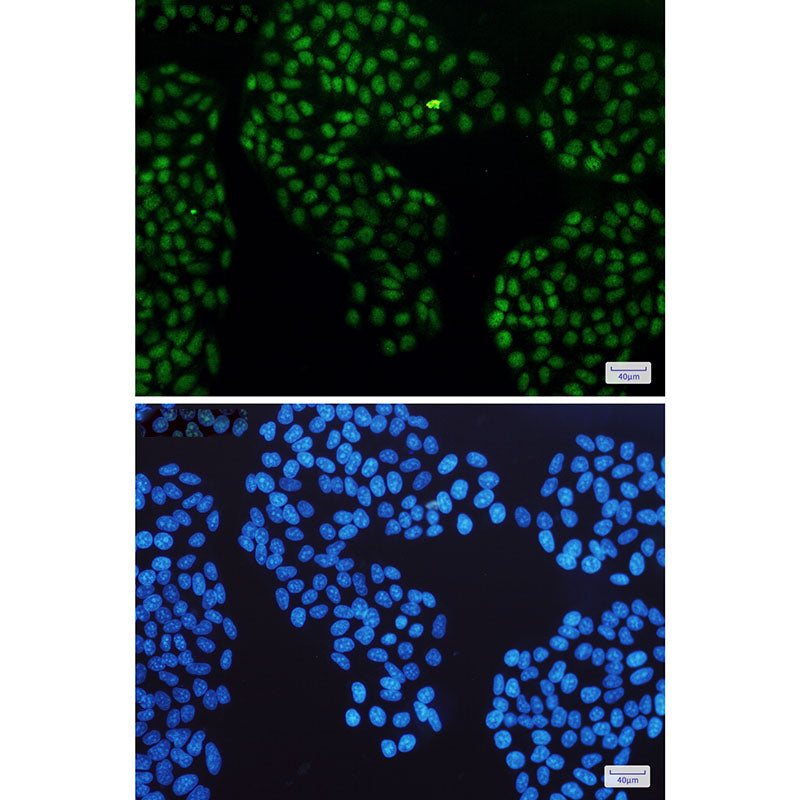Anti-Glucocorticoid Receptor Rabbit Monoclonal Antibody