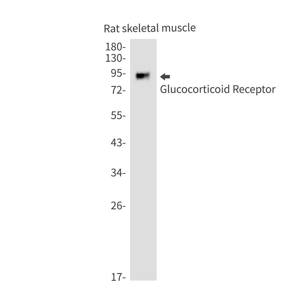Anti-Glucocorticoid Receptor Rabbit Monoclonal Antibody