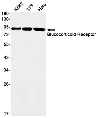 Anti-Glucocorticoid Receptor Rabbit Monoclonal Antibody