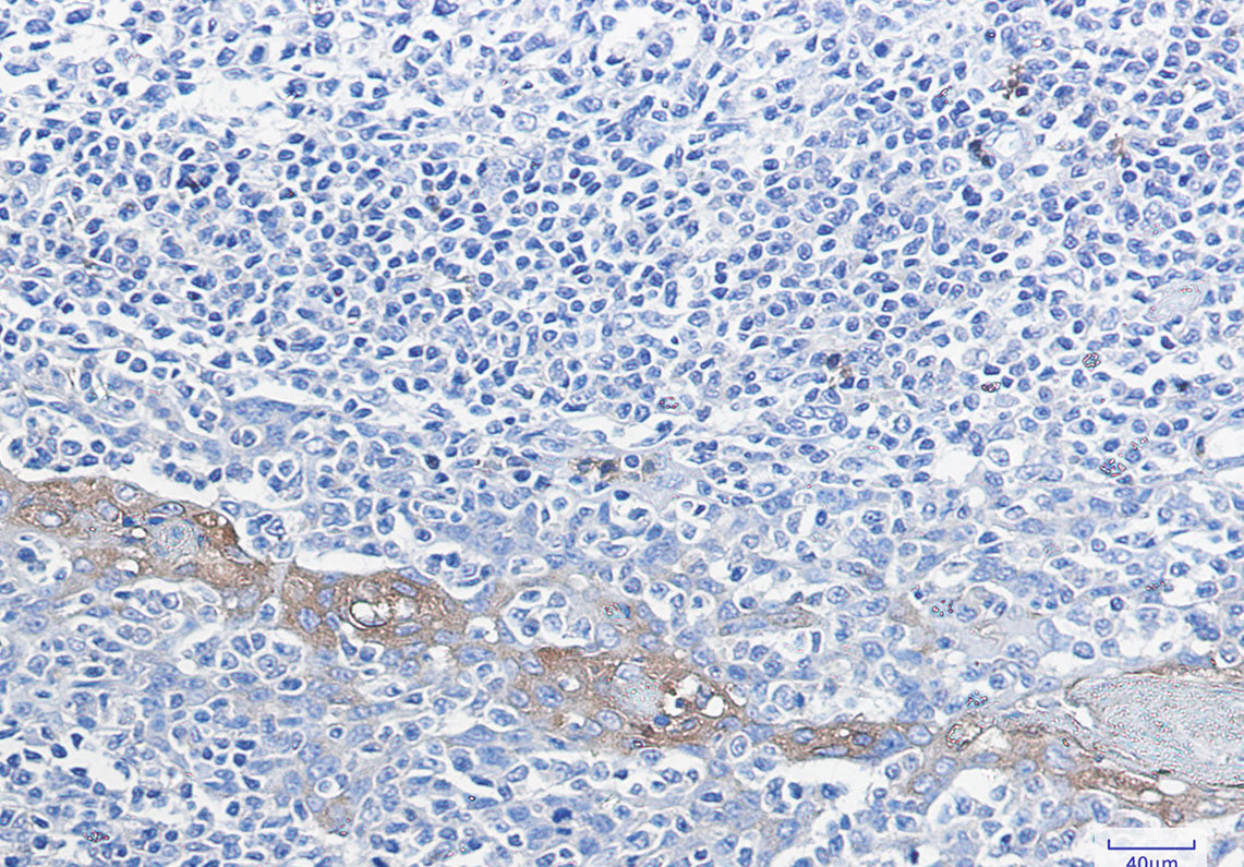 Anti-Glucose 6 Phosphate Dehydrogenase Rabbit Monoclonal Antibody