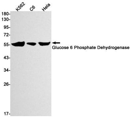 Anti-Glucose 6 Phosphate Dehydrogenase Rabbit Monoclonal Antibody