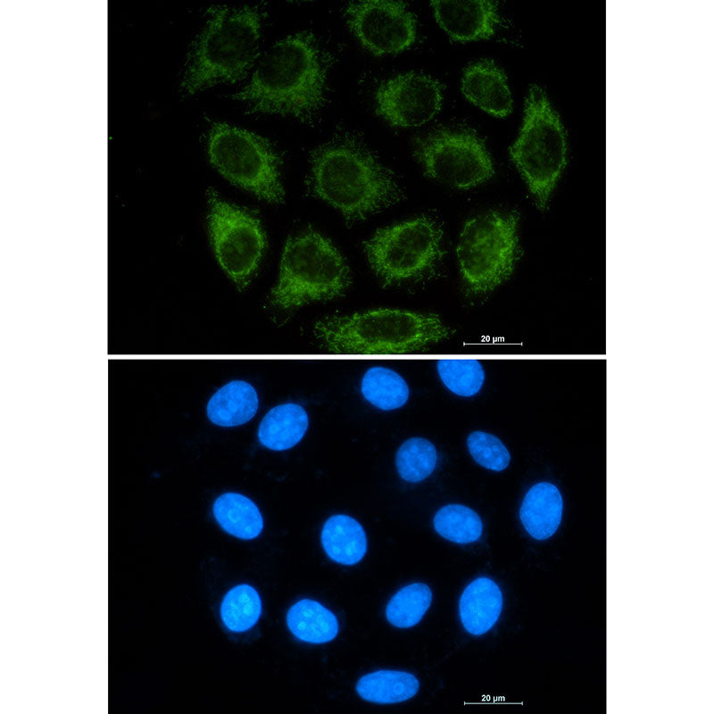 Anti-Glutaminase Rabbit Monoclonal Antibody