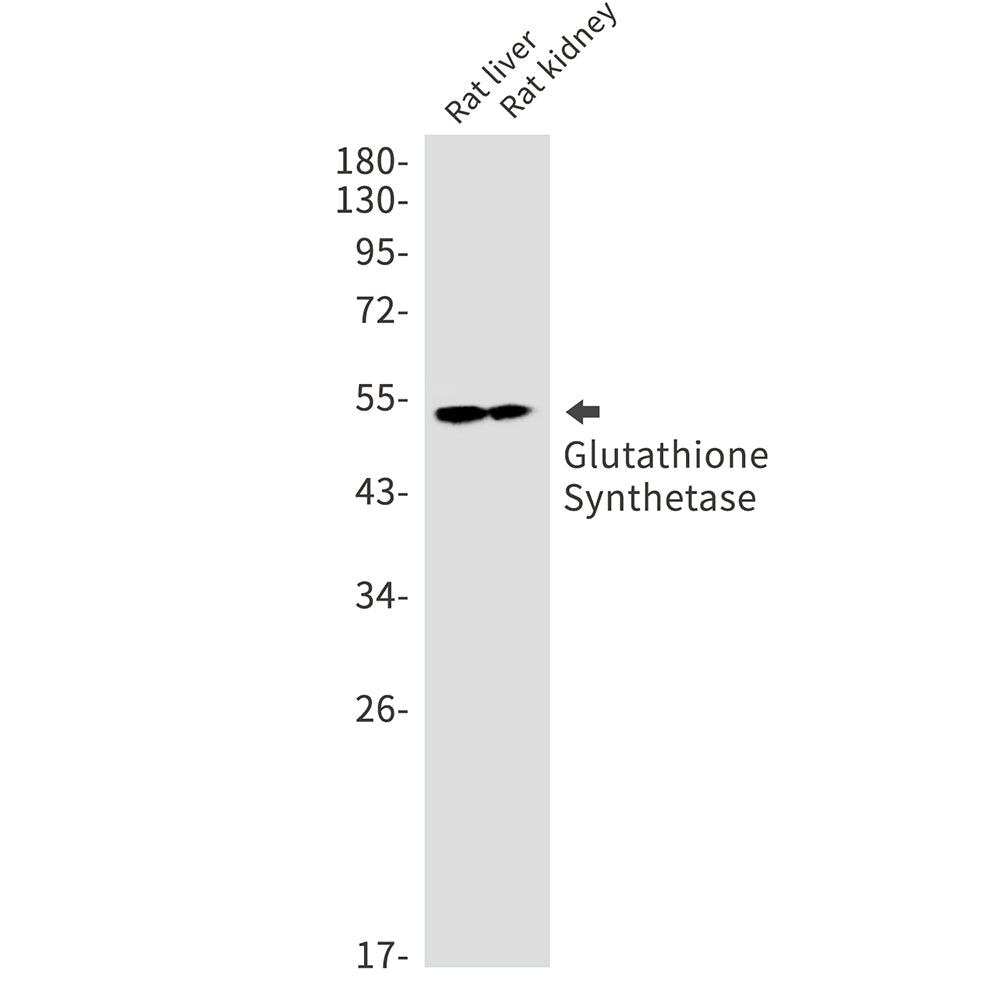 Anti-Glutathione Synthetase Rabbit Monoclonal Antibody