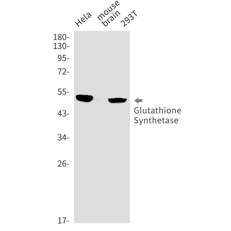 Anti-Glutathione Synthetase Rabbit Monoclonal Antibody