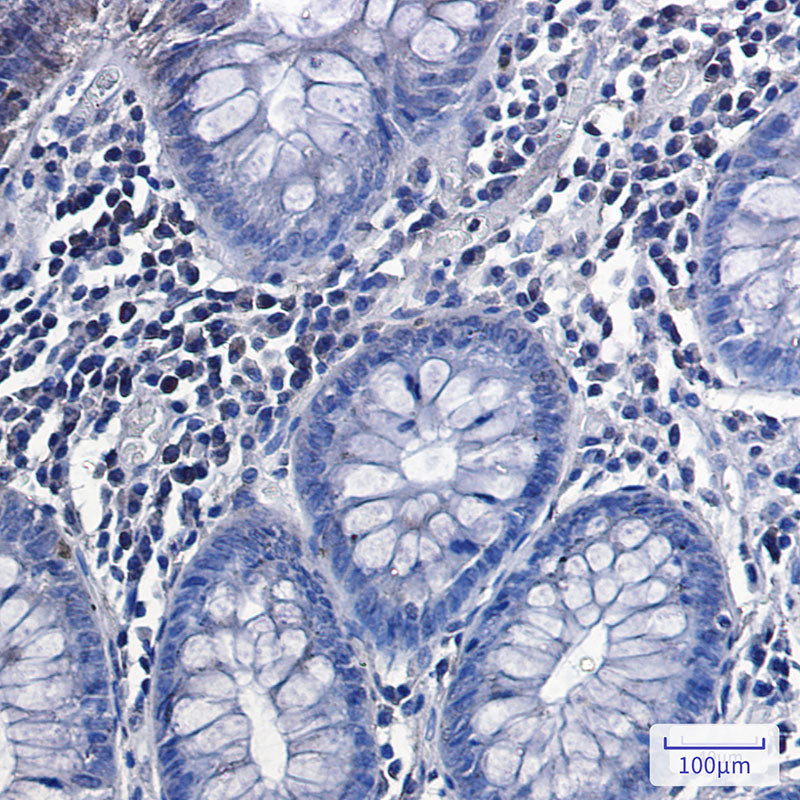 Anti-Phospho-Glycogen synthase (Ser641) Rabbit Monoclonal Antibody