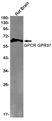 Anti-GPR37 Rabbit Monoclonal Antibody