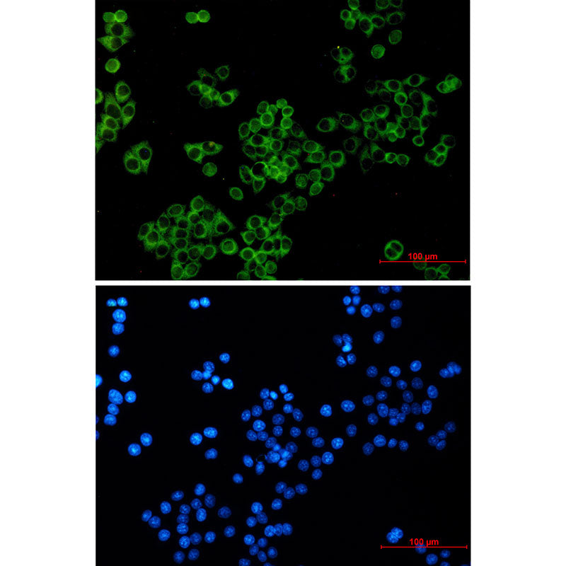 Anti-LGR6 Rabbit Monoclonal Antibody