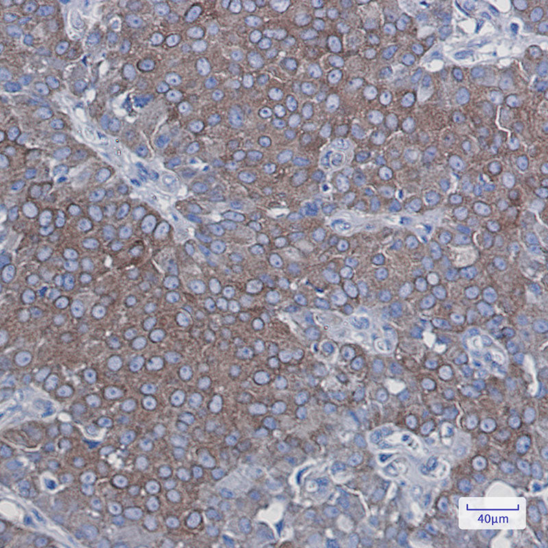 Anti-LGR6 Rabbit Monoclonal Antibody