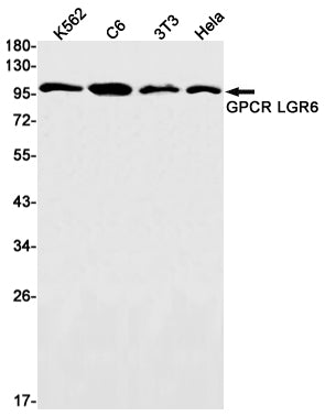 Anti-LGR6 Rabbit Monoclonal Antibody