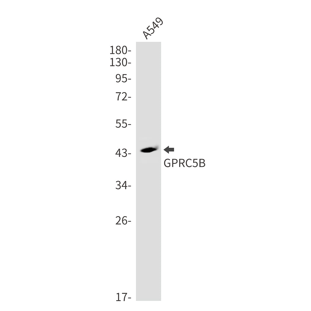 Anti-GPRC5B Rabbit Monoclonal Antibody