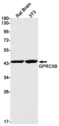 Anti-GPRC5B Rabbit Monoclonal Antibody