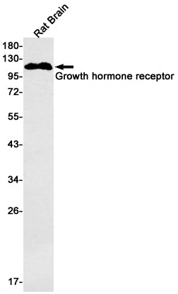 Anti-Growth Hormone Receptor Rabbit Monoclonal Antibody