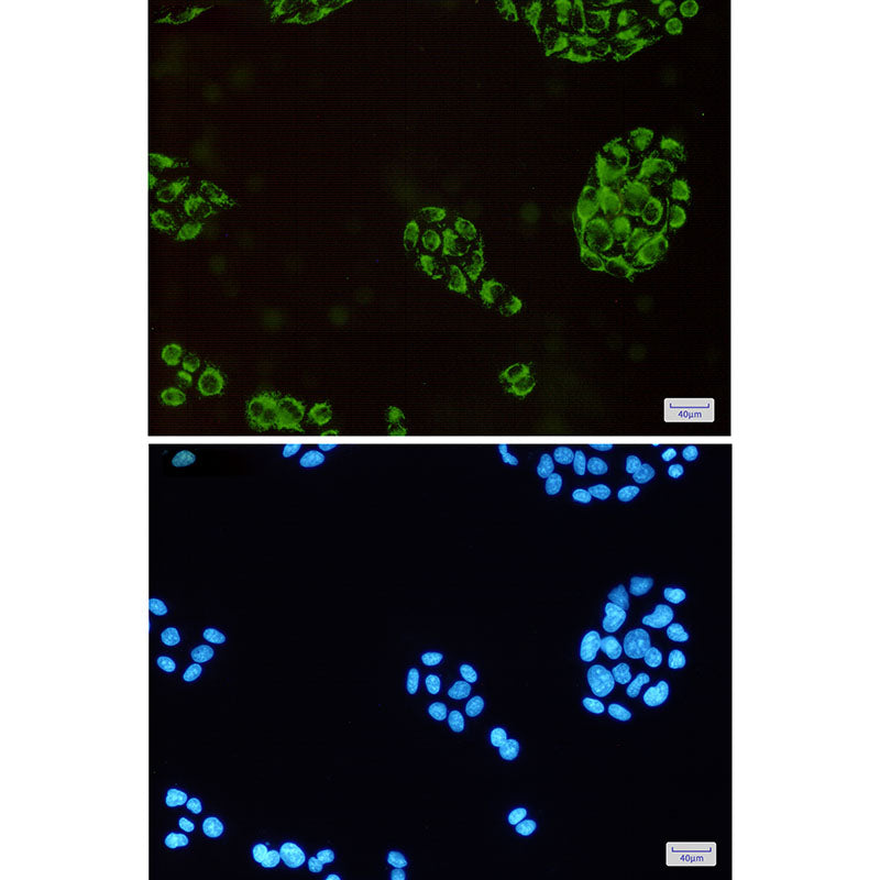 Anti-HADHA Rabbit Monoclonal Antibody