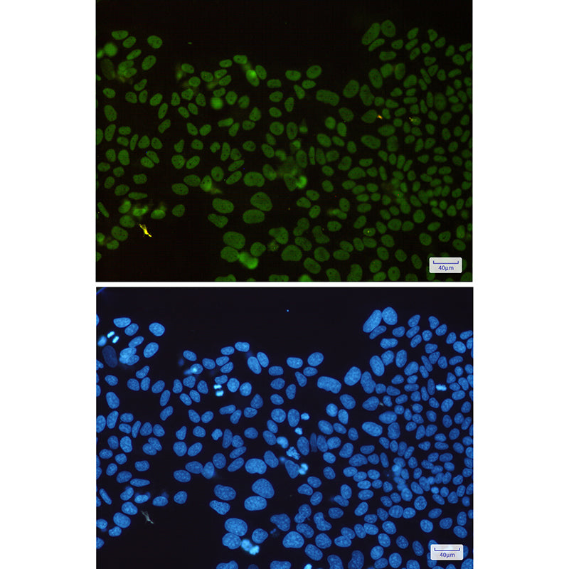 Anti-HDAC2 Rabbit Monoclonal Antibody