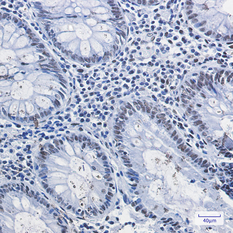 Anti-HDAC2 Rabbit Monoclonal Antibody