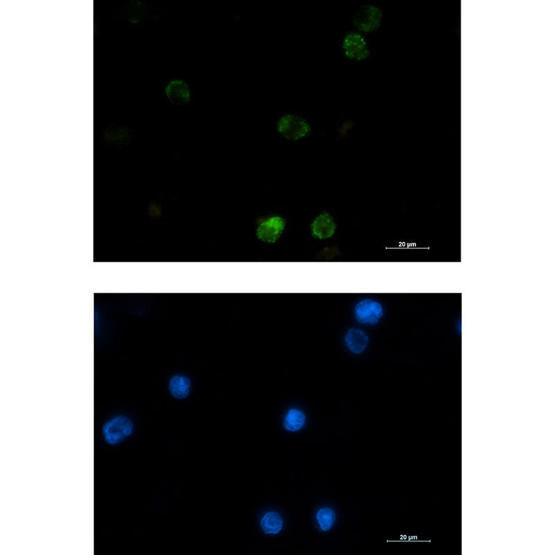Anti-Hexokinase I Rabbit Monoclonal Antibody