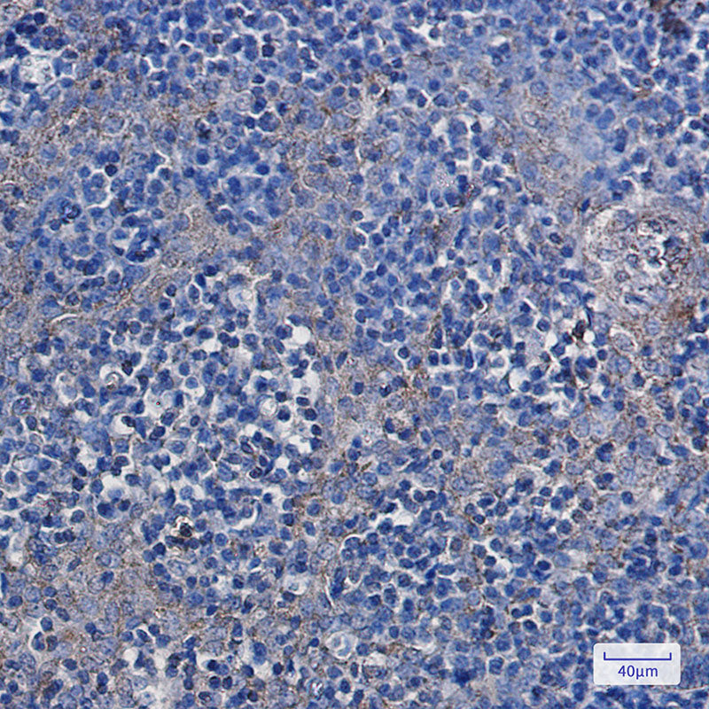 Anti-Hexokinase I Rabbit Monoclonal Antibody