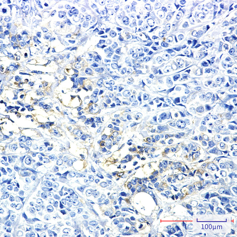 Anti-Hexokinase II Rabbit Monoclonal Antibody