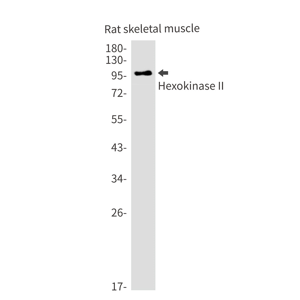 Anti-Hexokinase II Rabbit Monoclonal Antibody