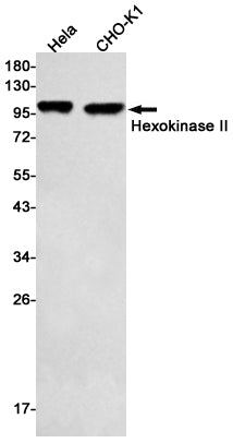Anti-Hexokinase II Rabbit Monoclonal Antibody