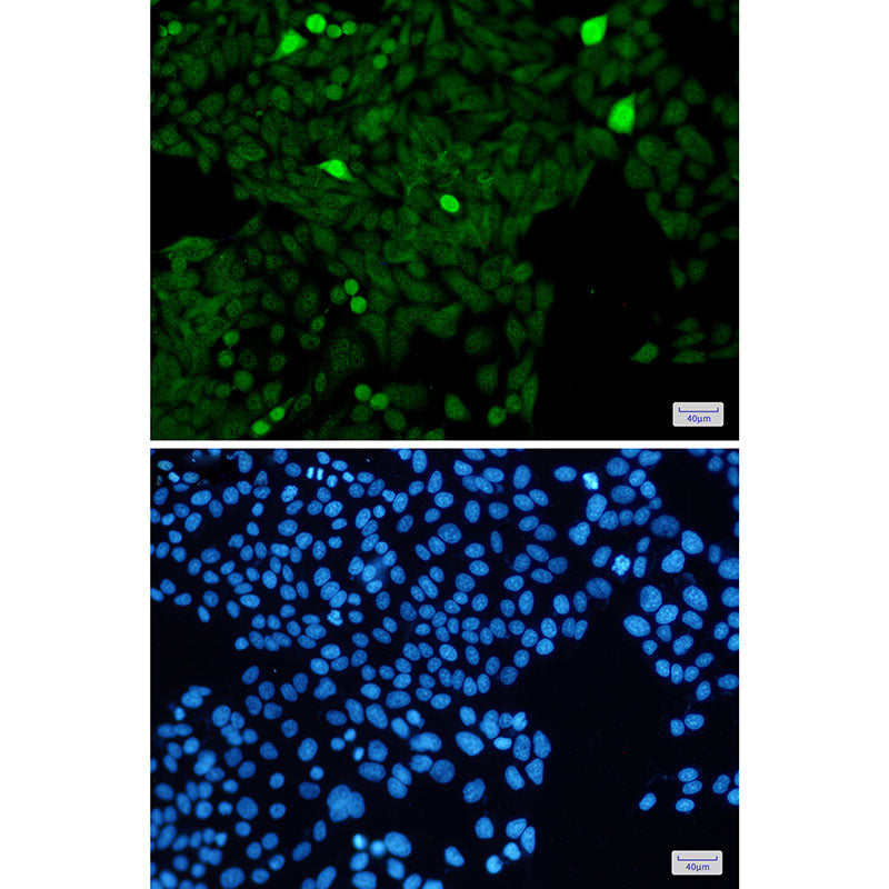 Anti-Phospho-Histone H3 (Ser28) Rabbit Monoclonal Antibody