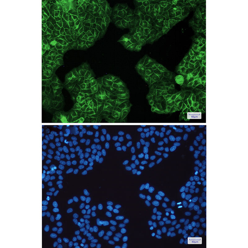 Anti-HLA A Rabbit Monoclonal Antibody