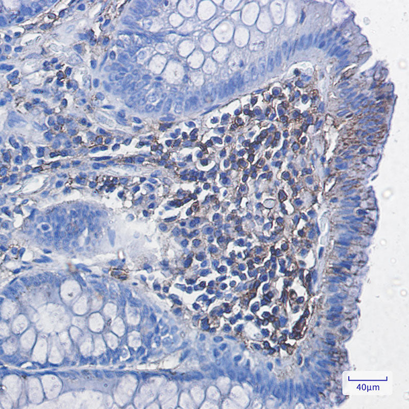 Anti-HLA A Rabbit Monoclonal Antibody