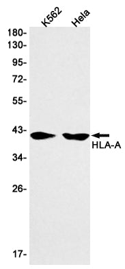 Anti-HLA A Rabbit Monoclonal Antibody