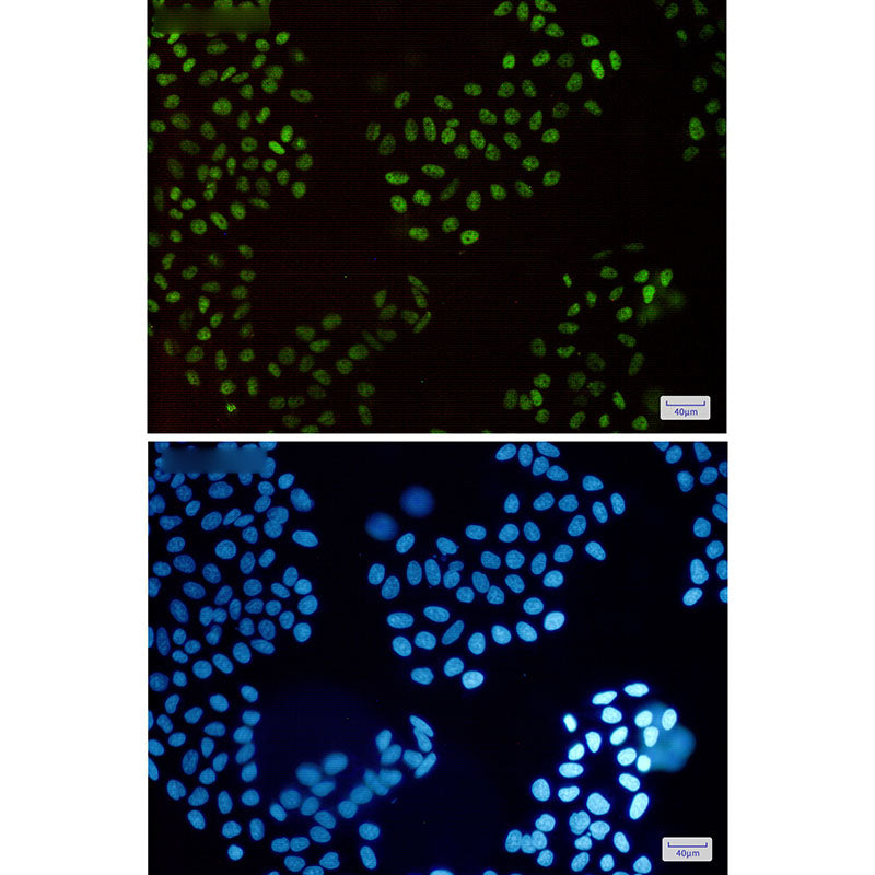 Anti-HLTF Rabbit Monoclonal Antibody