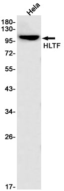 Anti-HLTF Rabbit Monoclonal Antibody