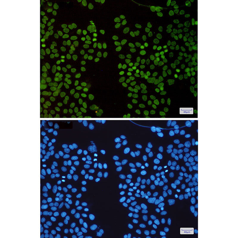 Anti-HMGA1 Rabbit Monoclonal Antibody