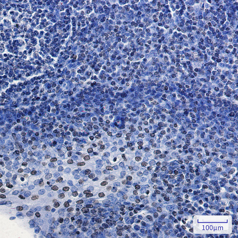 Anti-HMGA1 Rabbit Monoclonal Antibody