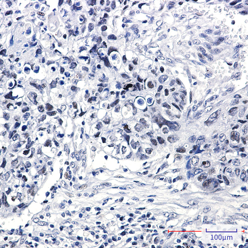 Anti-hnRNP K Rabbit Monoclonal Antibody