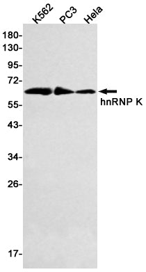 Anti-hnRNP K Rabbit Monoclonal Antibody