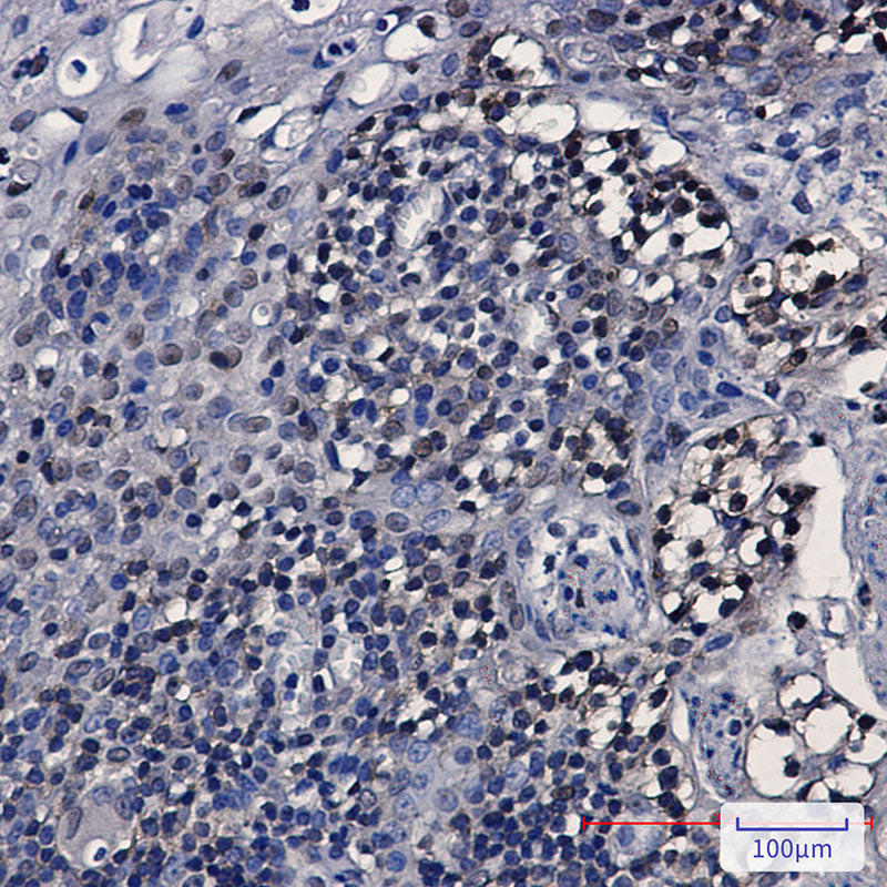 Anti-hnRNP K Rabbit Monoclonal Antibody
