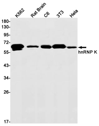 Anti-hnRNP K Rabbit Monoclonal Antibody