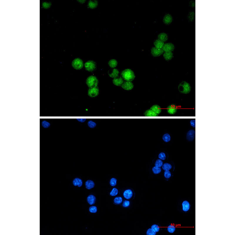 Anti-hnRNP K Rabbit Monoclonal Antibody