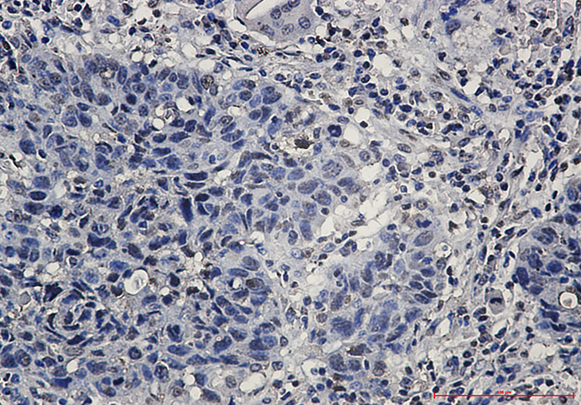 Anti-hnRNP K Rabbit Monoclonal Antibody