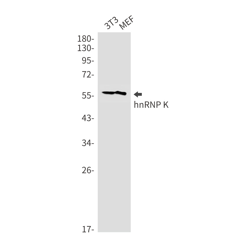 Anti-hnRNP K Rabbit Monoclonal Antibody
