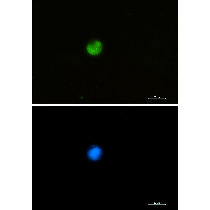 Anti-hnRNP M Rabbit Monoclonal Antibody