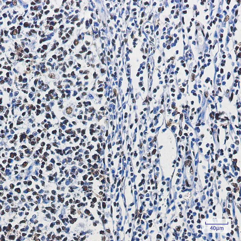 Anti-hnRNP M Rabbit Monoclonal Antibody