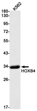 Anti-HOXB4 Rabbit Monoclonal Antibody